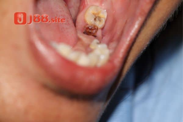 Ý nghĩa thông điệp khi chiêm bao thấy rụng răng Ý nghĩa thông điệp khi chiêm bao thấy rụng răng